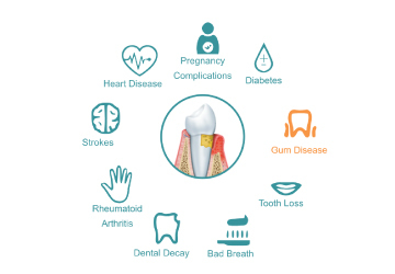 Infographic showing causes of bad breath related to dental and health issues.