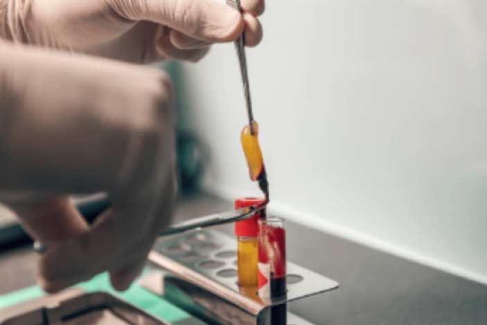 A person using a tool to place a yellow and red object into a container.