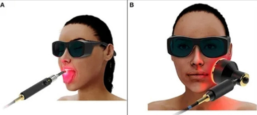 Side-by-side images of a woman wearing dark sunglasses and a mouthpiece.