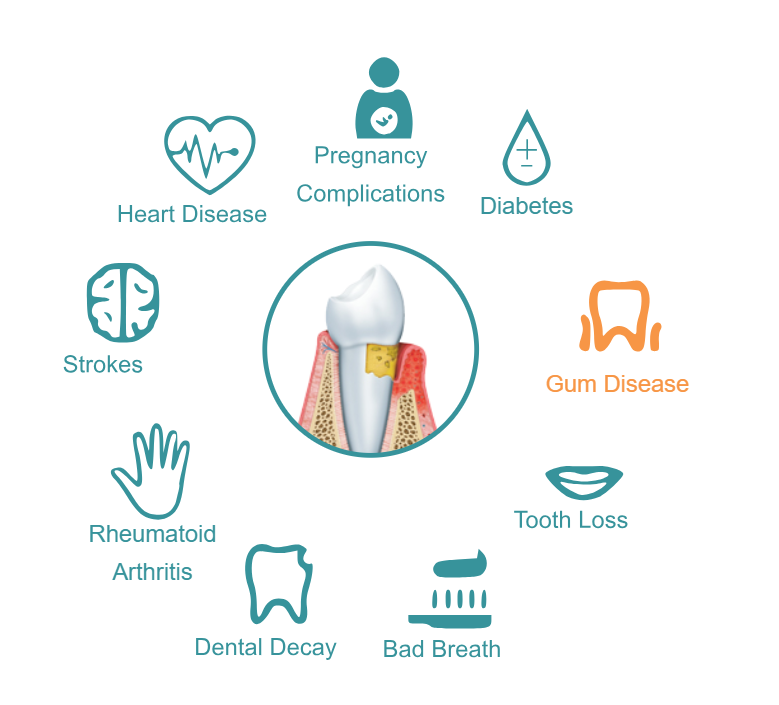 Infographic showing oral health links to various systemic diseases and conditions.