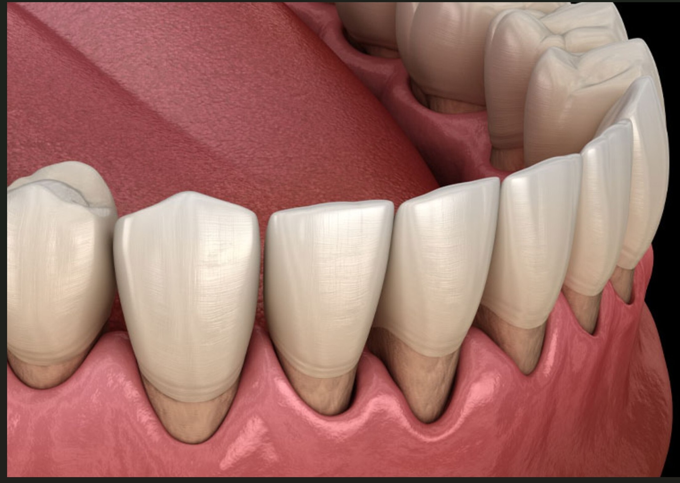 Close-up of healthy lower front teeth and gums.